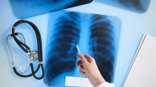 В Краснодаре День здоровья посвятят профилактике туберкулеза